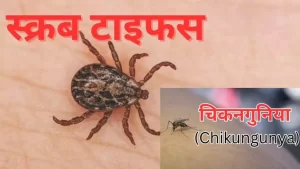 Dengue and chikungunya 