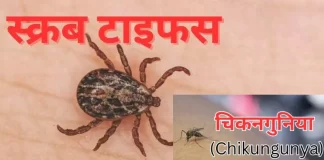 Dengue and chikungunya 